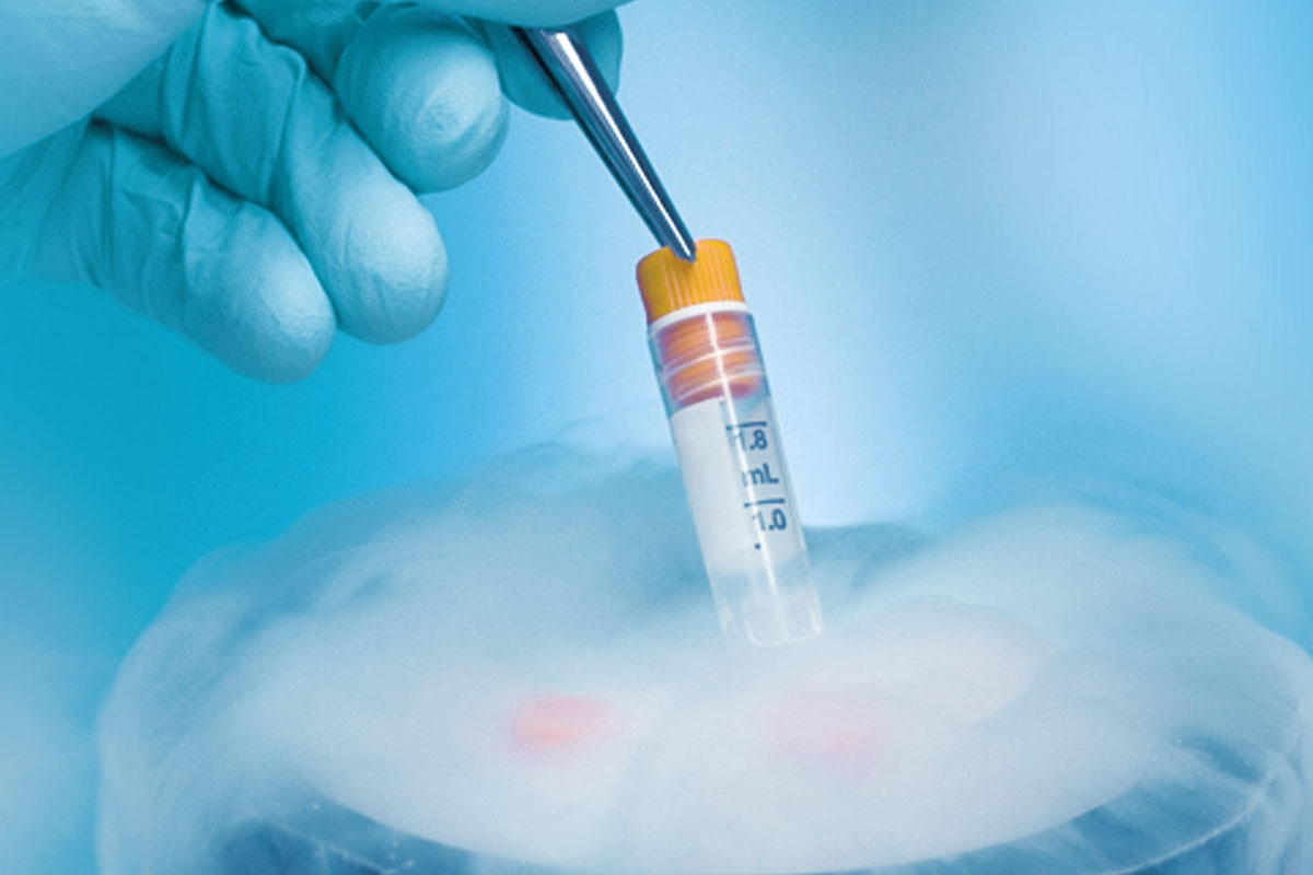 How Long Can Sperm Be Frozen for IVF?