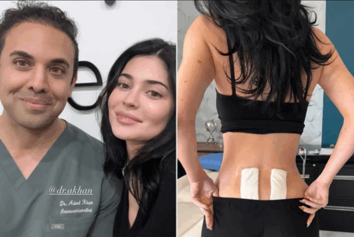 Kylie Jenner Stem Cell Therapy