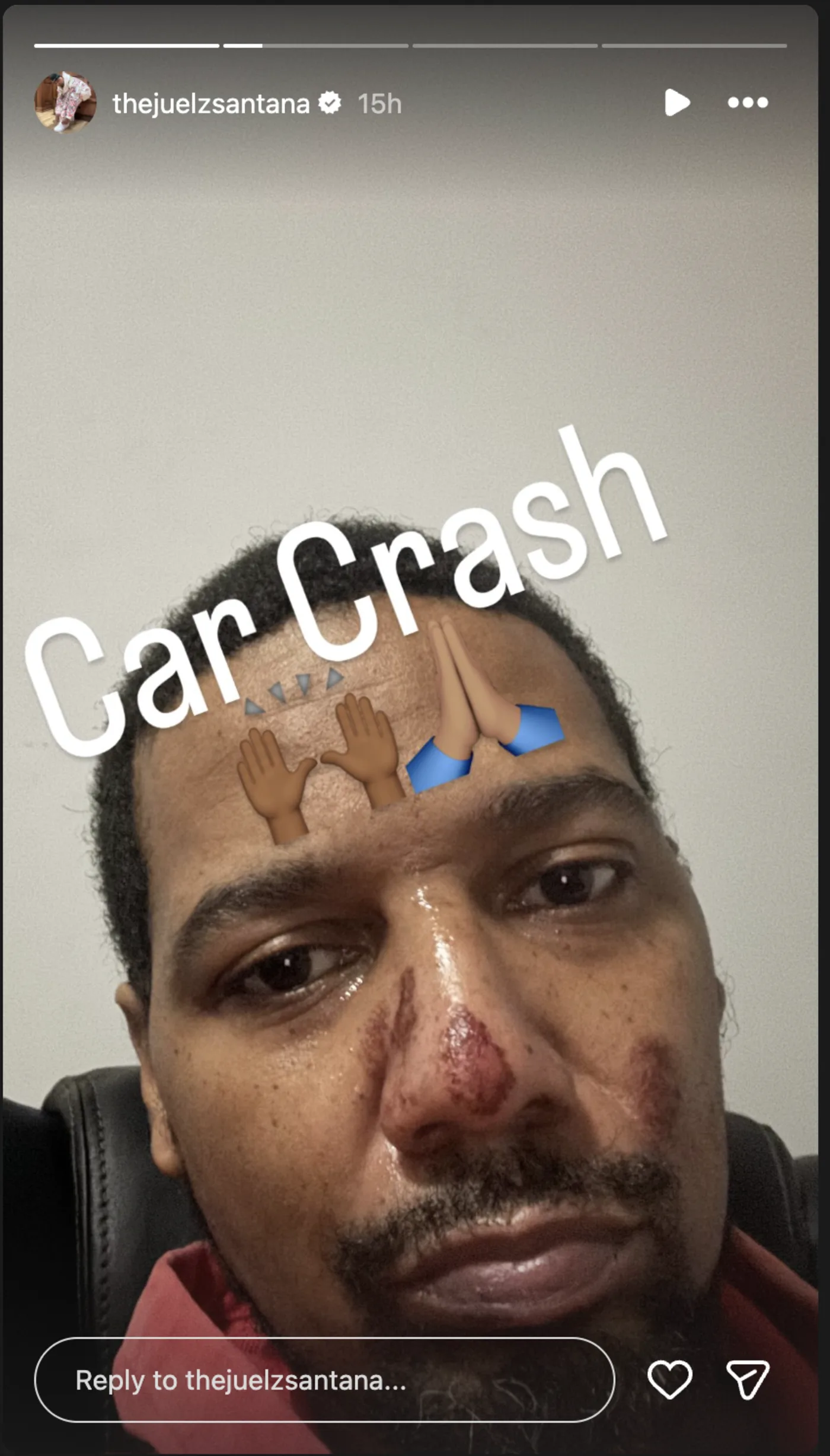 Juelz Santana Sparks Concern After Revealing He Was Involved in a Car Crash